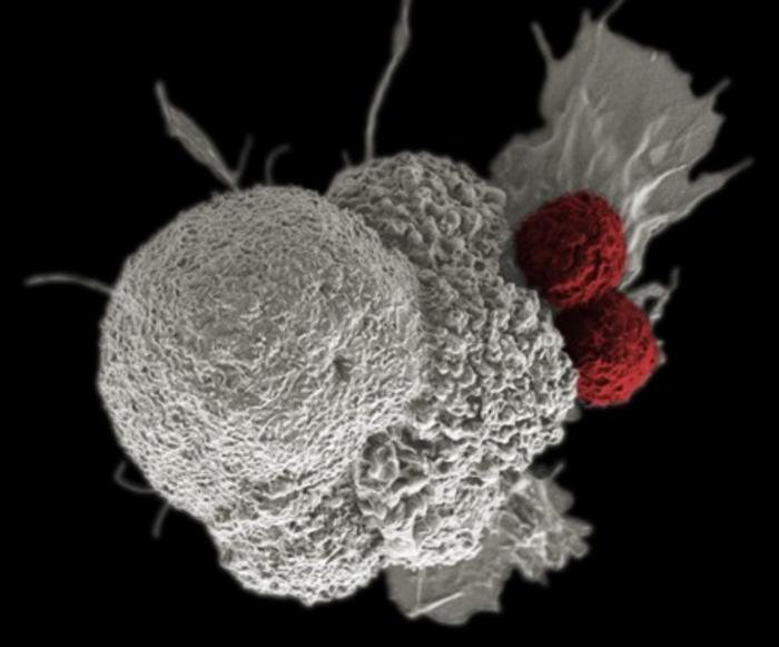 From ex vivo manufacturing to in vivo CAR-T therapy