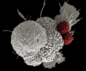 From ex vivo manufacturing to in vivo CAR-T therapy
