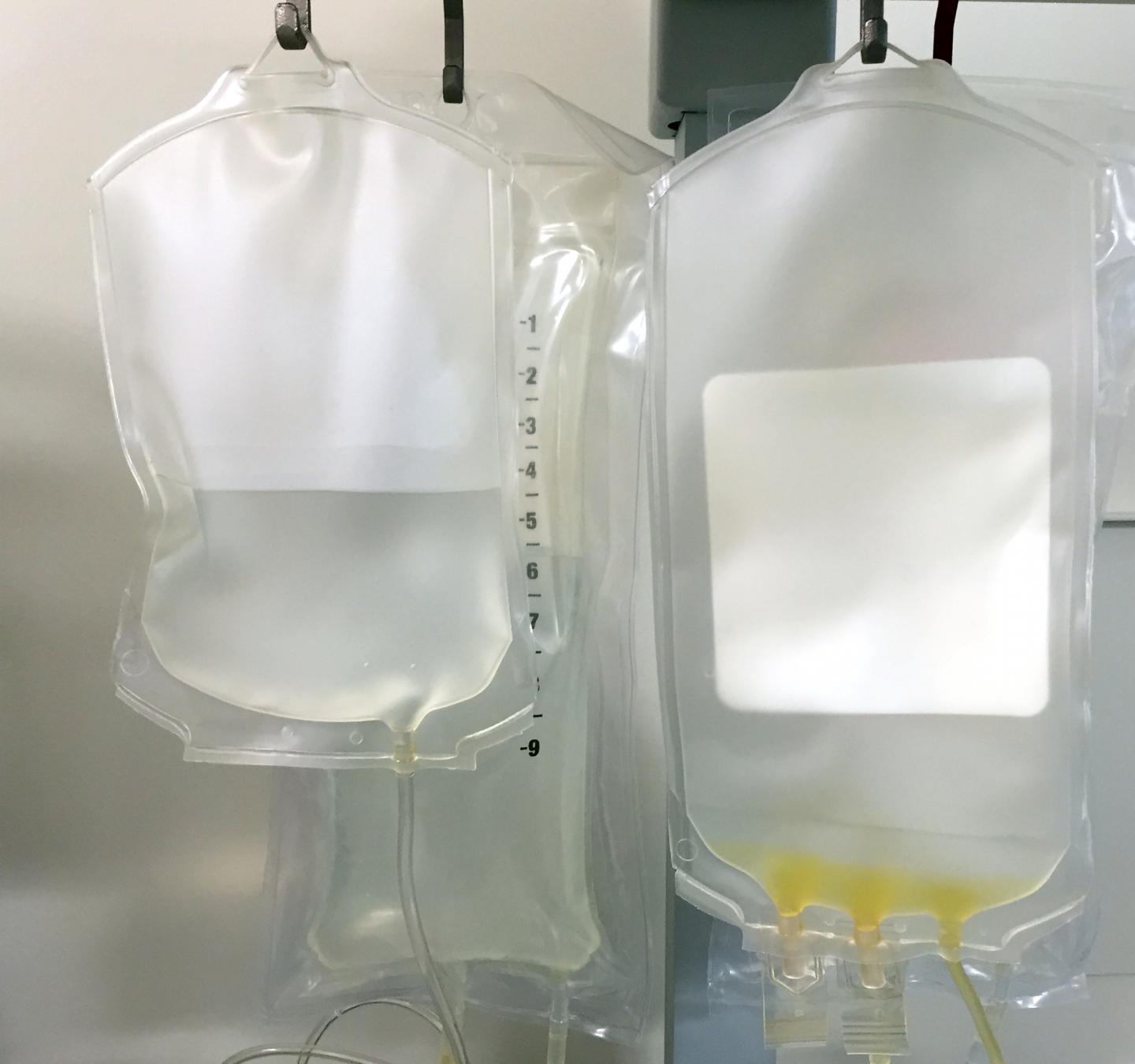 Bags of Fluid for Intravenous (IV) Infusions