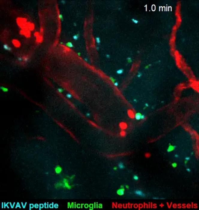 Post-stroke injection breaks blood-brain barrier, protects the brain