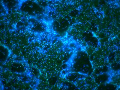 Biofilm