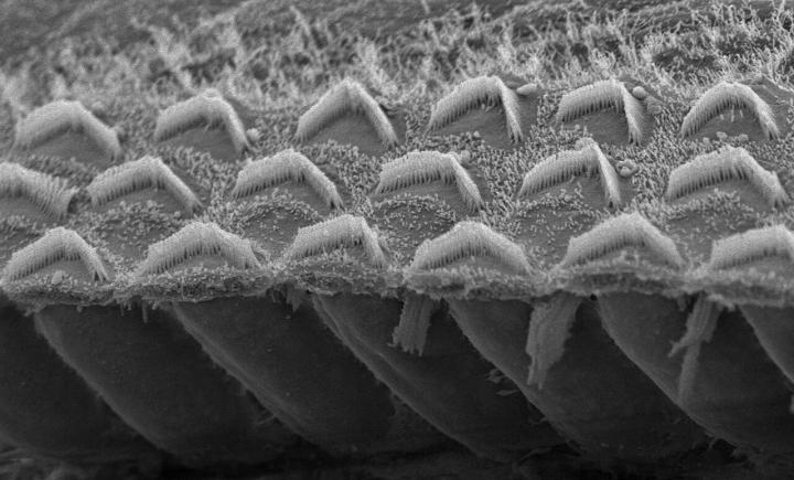 Closeup of Microvilli Bundles
