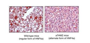 Soybean oil diet effects