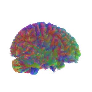 Era Four: A representative MRI tractography image of the fourth era of the human brain.