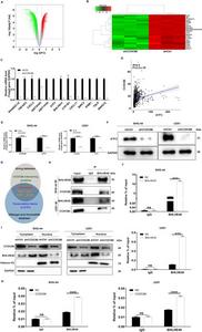 Exploring the downstream mechanism of CCDC86 regulating the progression of glioma.
