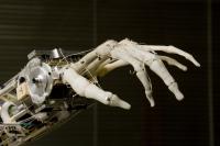 Prosthetic Hand