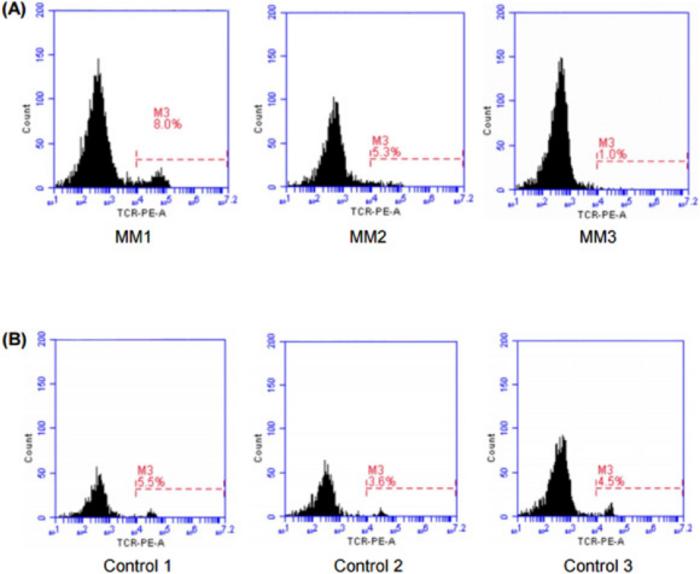 γδ T Cells in MM Patients vs Healthy Controls