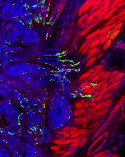 Leader Cells in a Mouse Breast Tumor