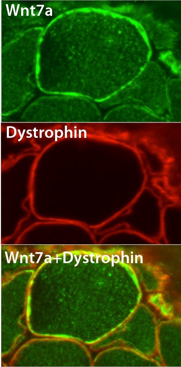 Wnt Proteins as Key Nerotrophic Factor