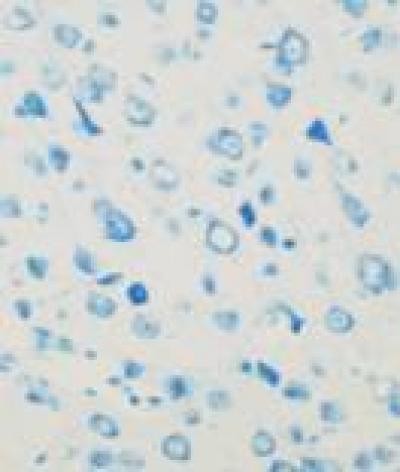 Neurons Exhibited Cell Shrinkage