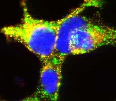 Beta Cells