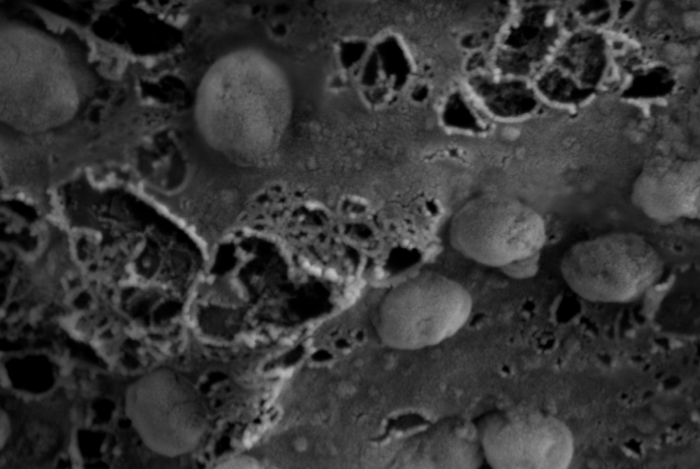 Exosomes