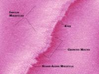 Mound of Insulin Blocks