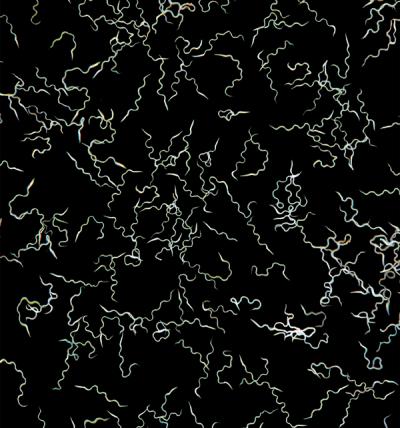 Mosquito Sperm