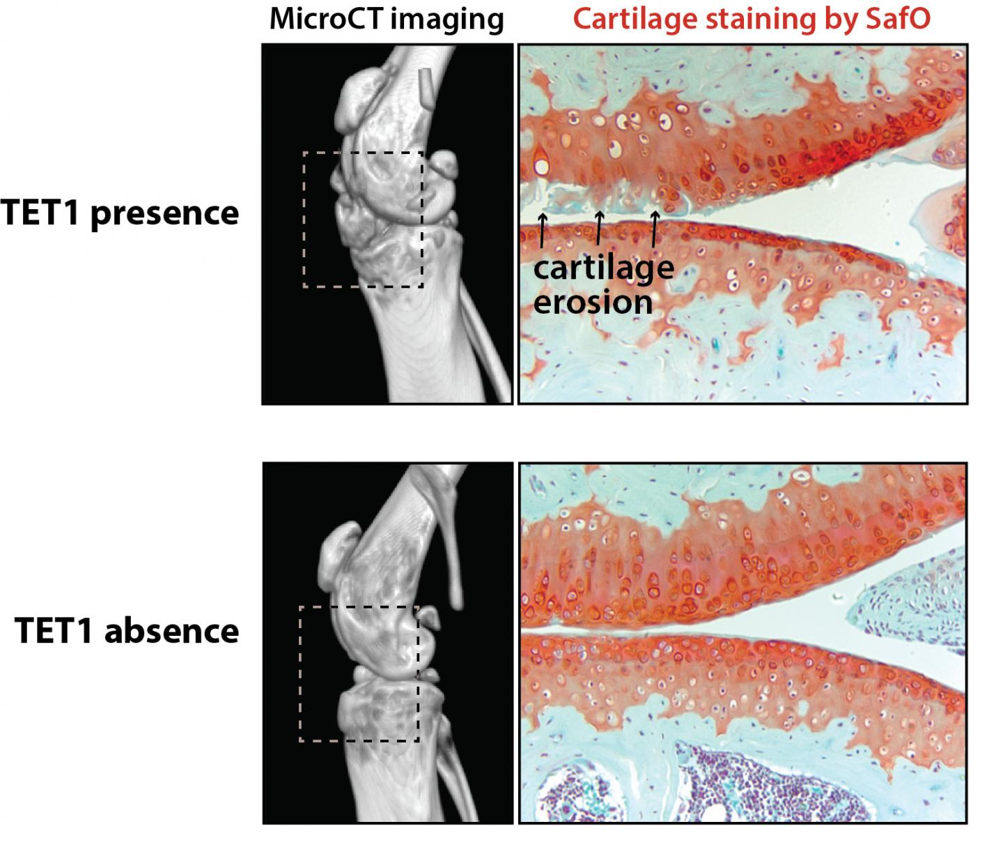 Three-Dimensional Cultures Reveal How Oxidative Stress Evolves in Breast Cancer (1 of 2)