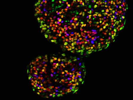 Pancreatic Stem Cells
