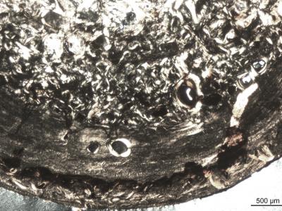 Histology of the Midshaft of <i>Metoposaurus</i> Femur