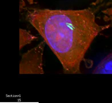 Bacteria in Tumors May Reduce the Efficacy of Cancer Chemotherapy (5 of 6)