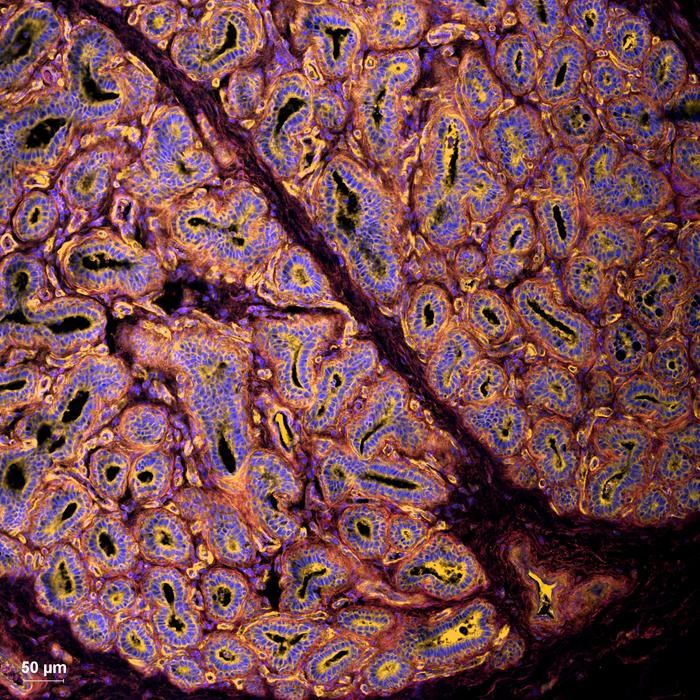 Microscopic image of bovine mammary gland tissue showing influenza virus receptors (yellow) on mammary epithelial cells.