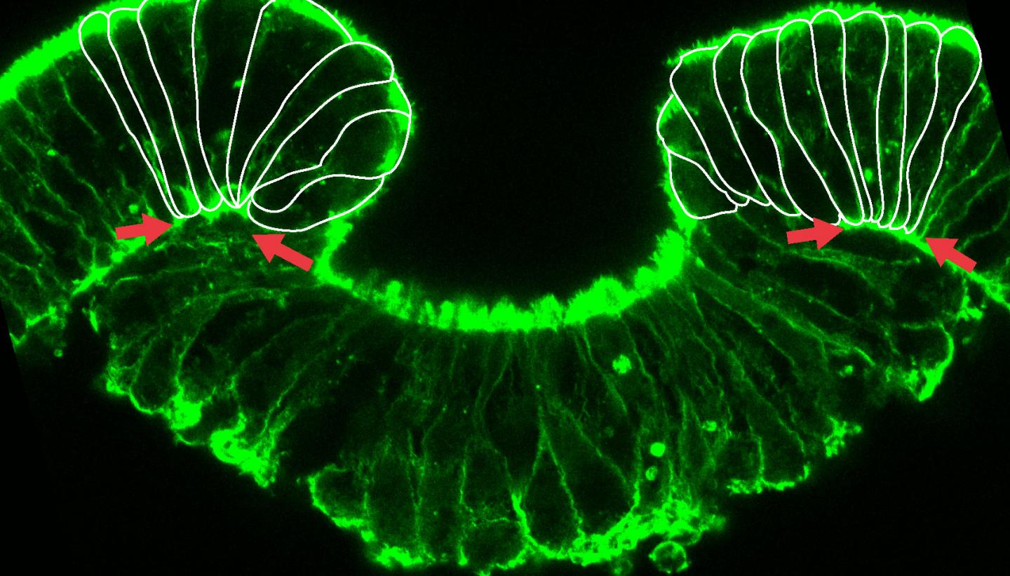 1 Early Stage of Invagination of the Inner Cell Layer