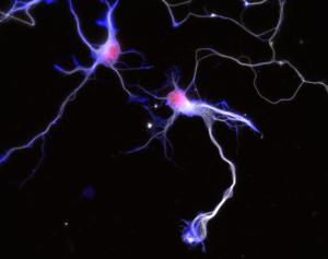 Immunostaining of cultured neurons