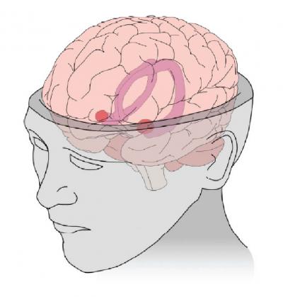 Hippocampus