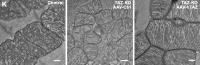 Normalizing cell mitochondria