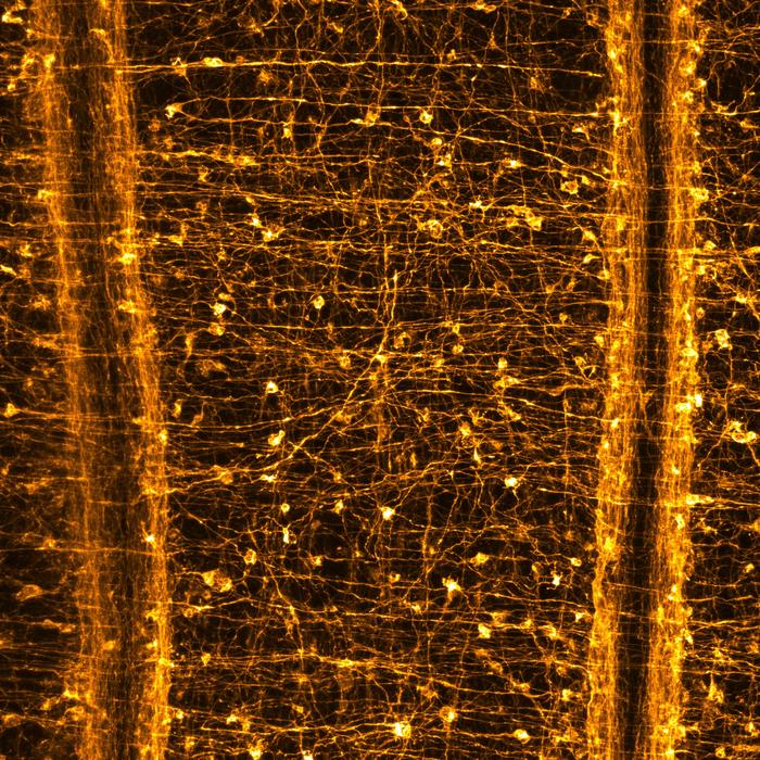 Bar-Ilan University Study Uncovers the Origin of Sleep in Jellyfish and Sea Anemones