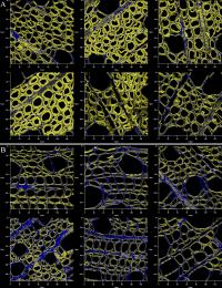 Bioenergy -- On the Surface