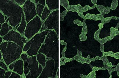 Foxc2 and NFATAc1 at Work