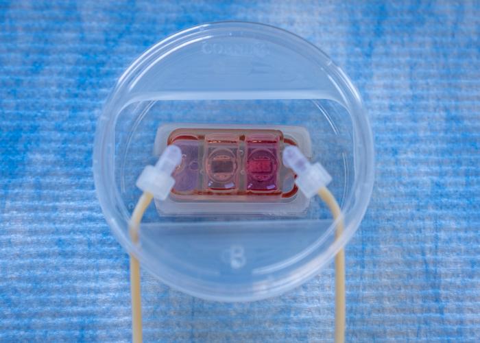 Organ on a Chip
