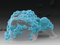 Healthy Platelets Pull The Post Toward The Block