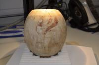 Examination of Ostrich Egg