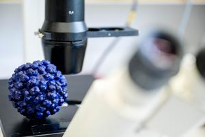 3D print model of Hepatitis E Virus