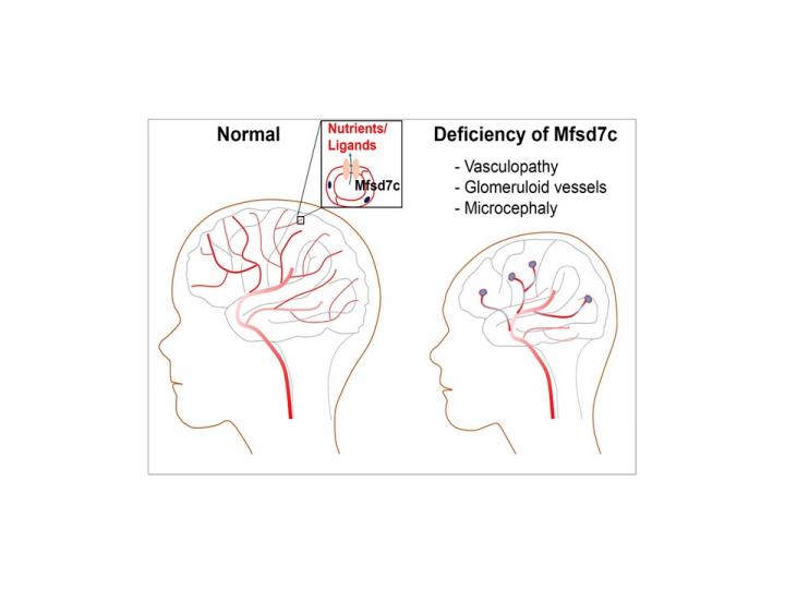 Deficiency