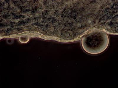 Malaria Oocyst