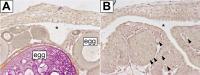 The Feminizing Effect is Inherent to Germ Cells Which are Essential for the Formation of Ovaries
