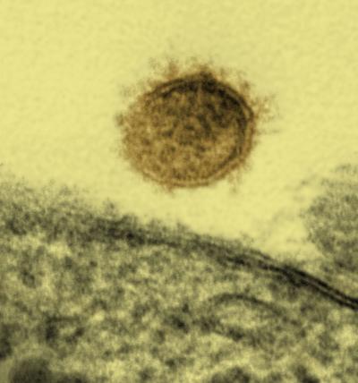 Sin Nombre Virus Particle