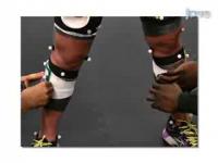 A Novel Application of Musculoskeletal Ultrasound Imaging