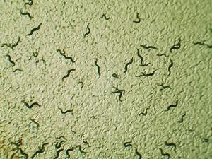 C. elegans worms show scientists how aging is programmed into their DNA