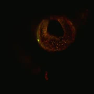 Hanna-iPS Derived Cells Movie (1 of 2)