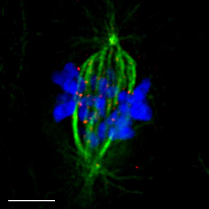 Human Epithelial Cell that Is Preparing to Divide into Two Daughter Cells