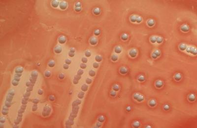 <i>Staphylococcus aureus</i> on Blood Agar