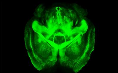 Clarity of the Brain