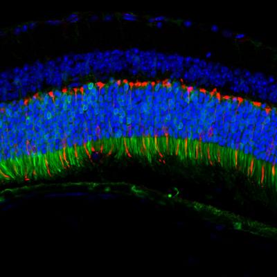 Anc80 in the Retina
