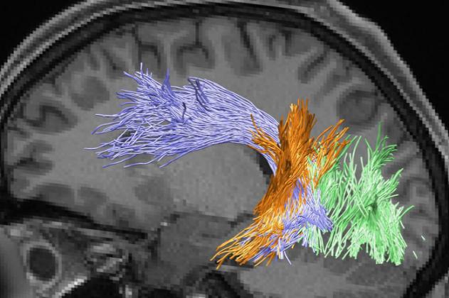 White Matter Pathways