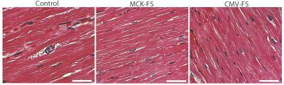 Mighty Monkeys: Bigger Muscles with Gene Therapy (2 of 2)