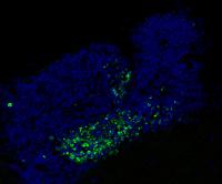 Brain Guardians Remove Dying Neurons