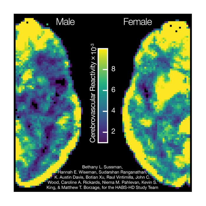 Brain reactivity differs by sex