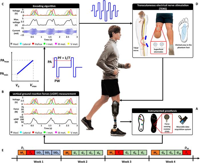 Sensory feedback restoration system overview and study design.